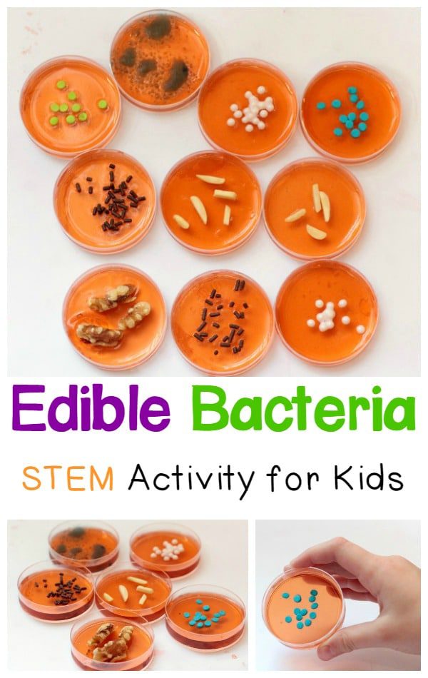 Gross out everyone at the Halloween party with this edible bacteria candy! Germs candy that looks just like real bacteria but is totally edible!
